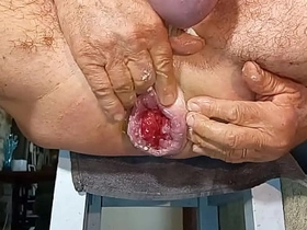 扩肛侠2025-14 pinoy kantutan gay porn